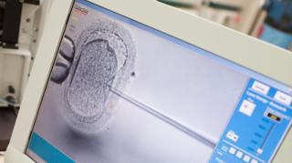 Debate Intensifies Over Embryo Screening Practices in IVF