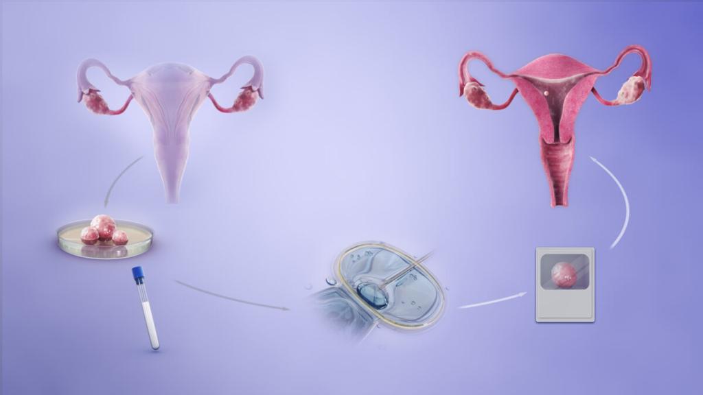 Debate Over Fertility Care and Women's Autonomy Intensifies