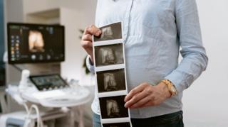 Pew Research Poll Reveals Complex Views on Abortion Amid Ongoing Debate