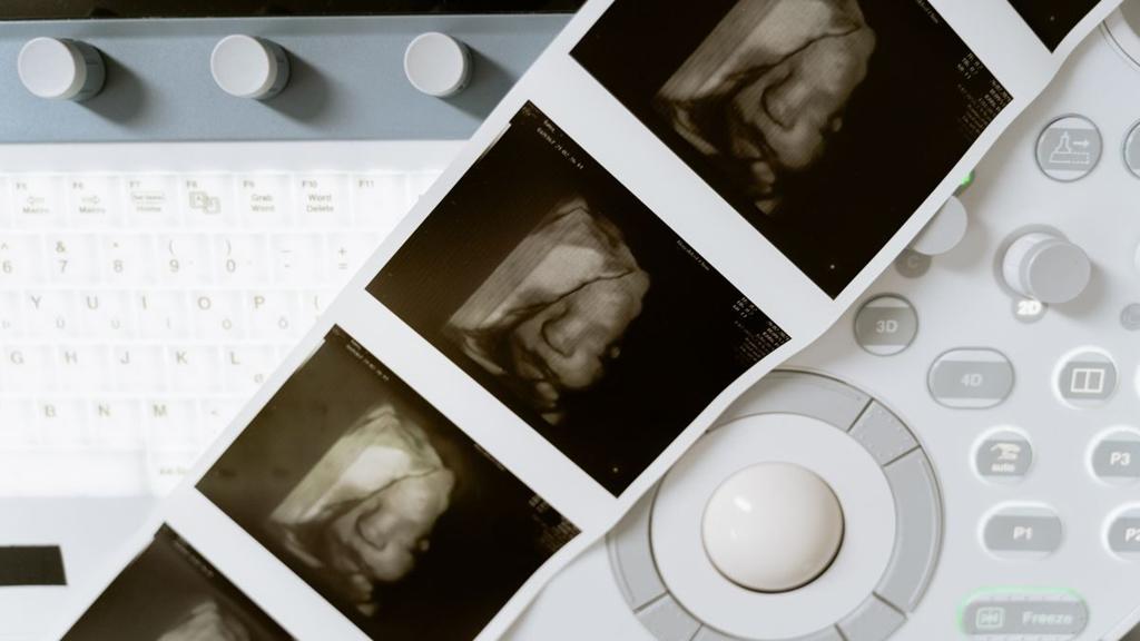 Father's Role Highlighted in Decisions on Prenatal Diagnoses