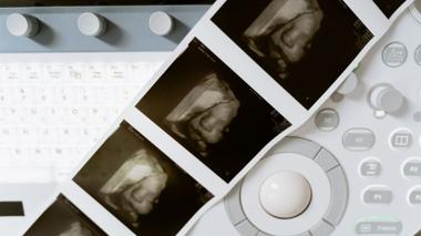 Father's Role Highlighted in Decisions on Prenatal Diagnoses