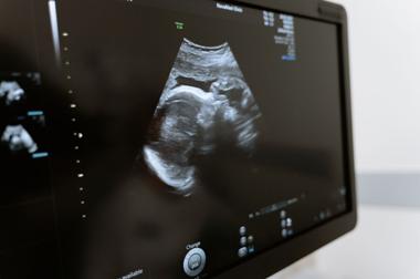 9th Circuit Temporarily Blocks Idaho Abortion Ruling, Restoring State Law