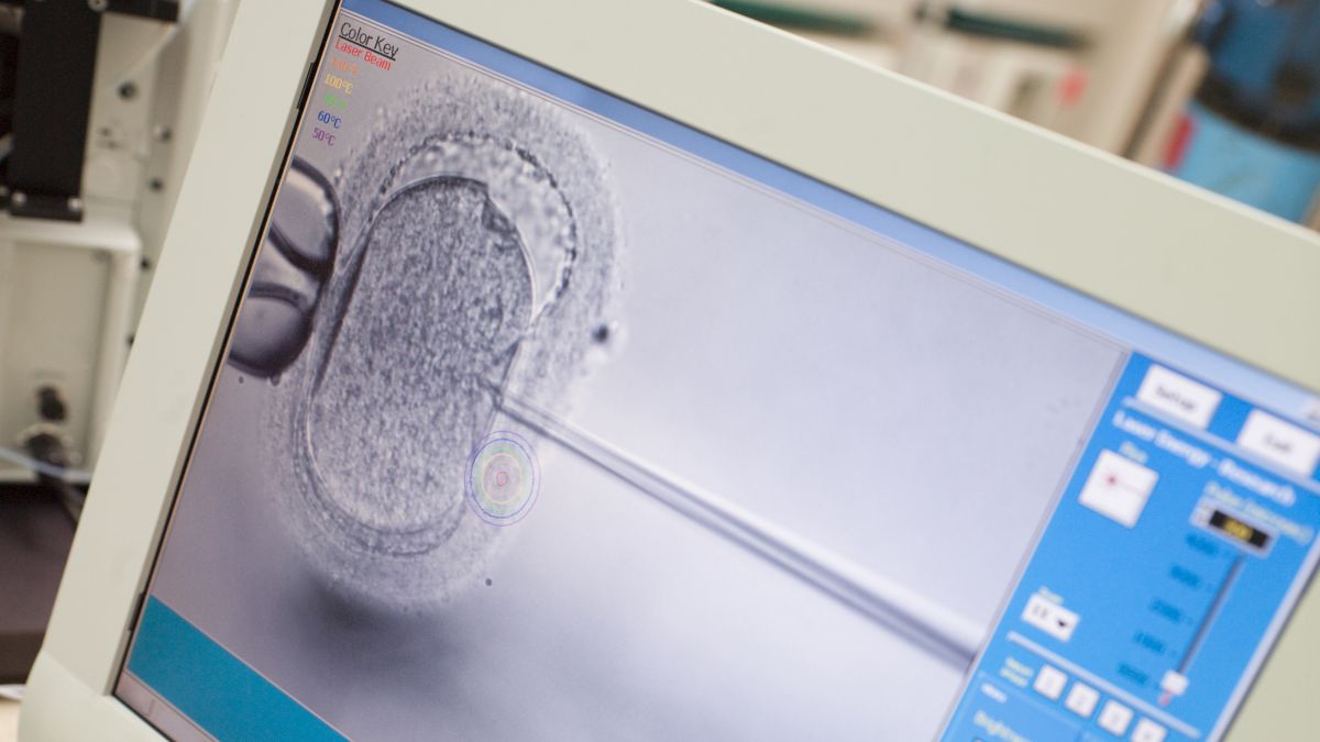 Debate Intensifies Over Embryo Screening Practices in IVF