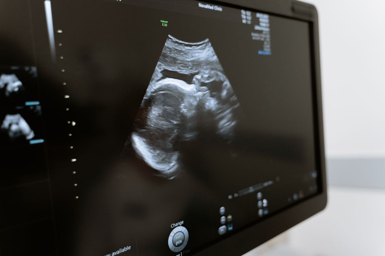 9th Circuit Temporarily Blocks Idaho Abortion Ruling, Restoring State Law